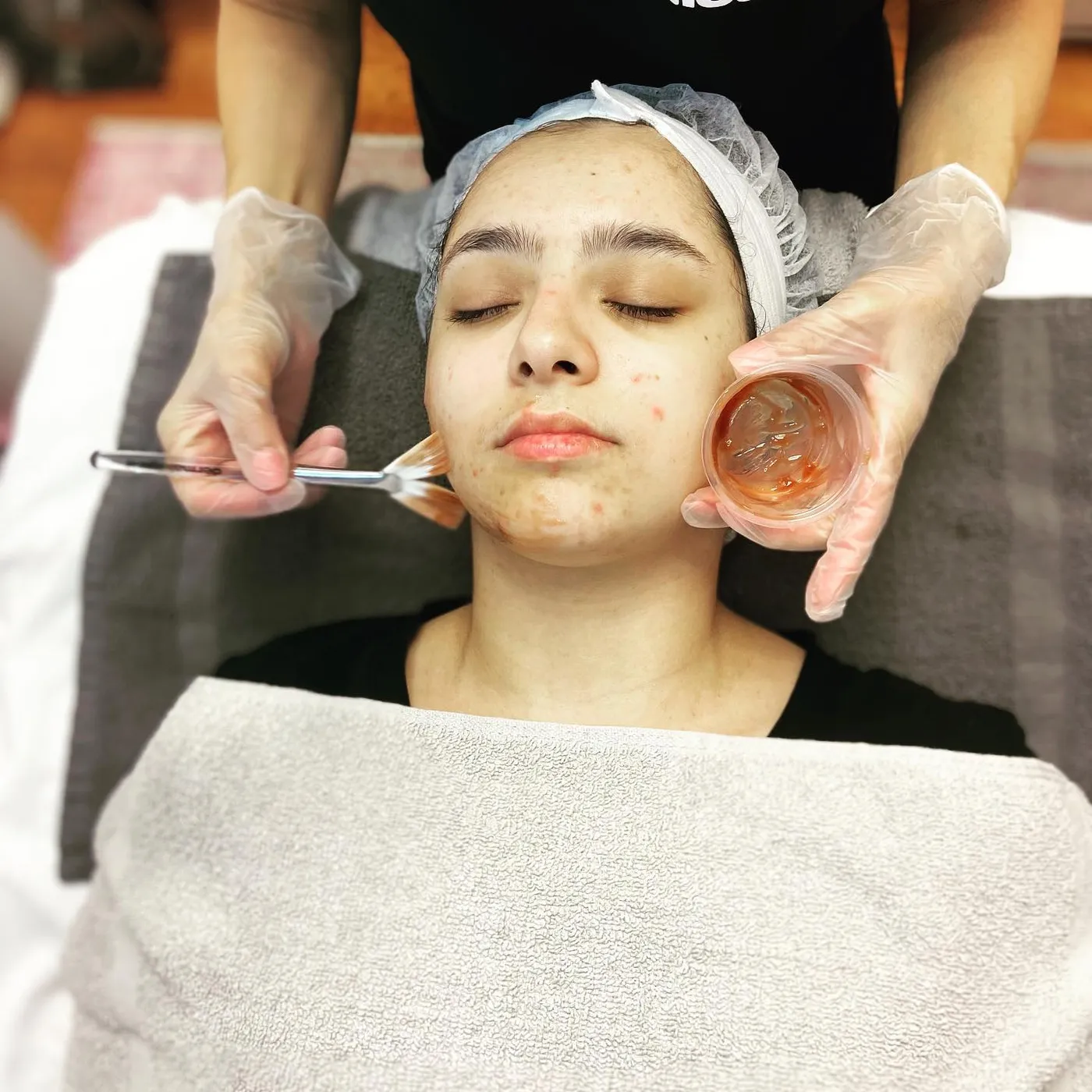 A peel being applied with a brush