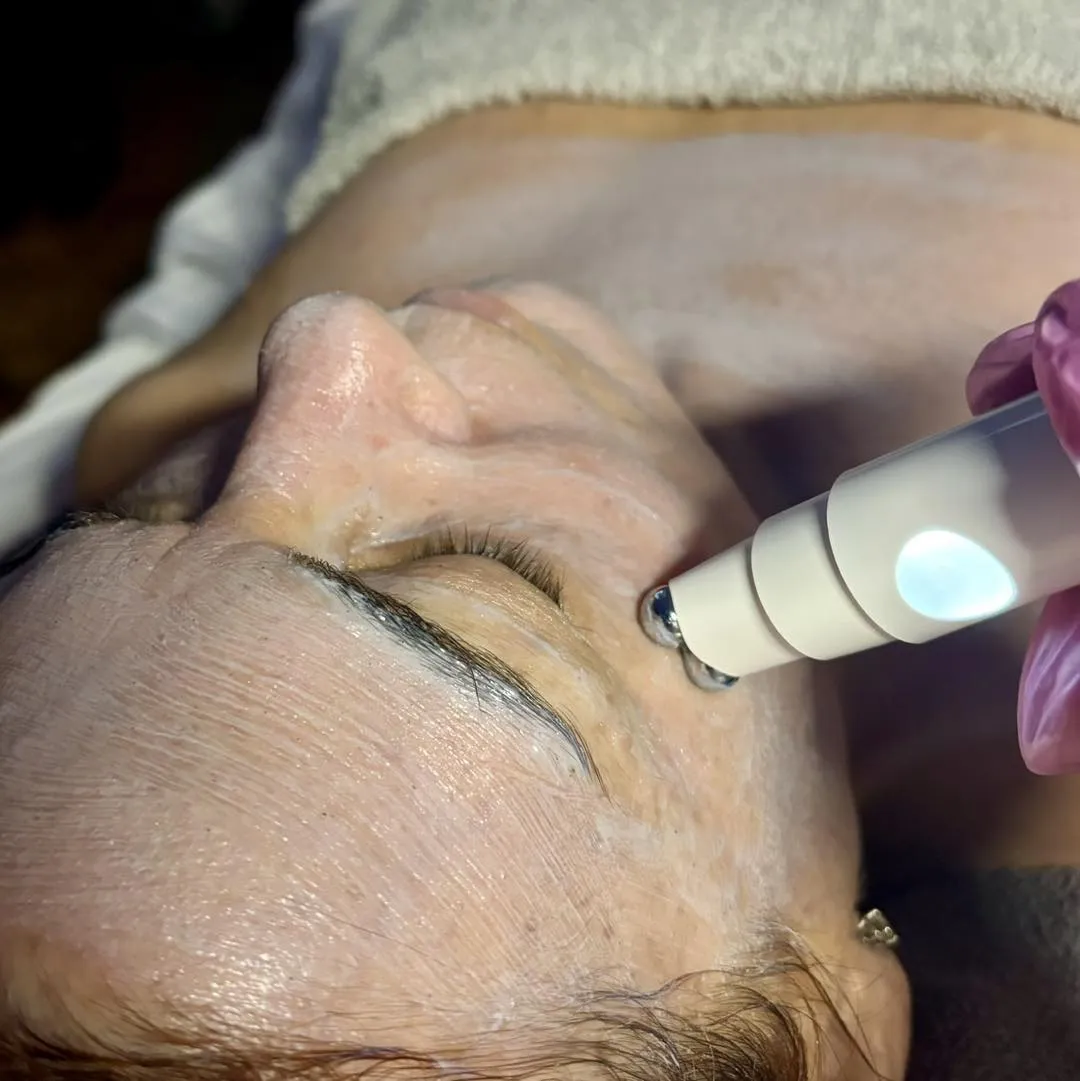 Microcurrent wands on a client's jawline