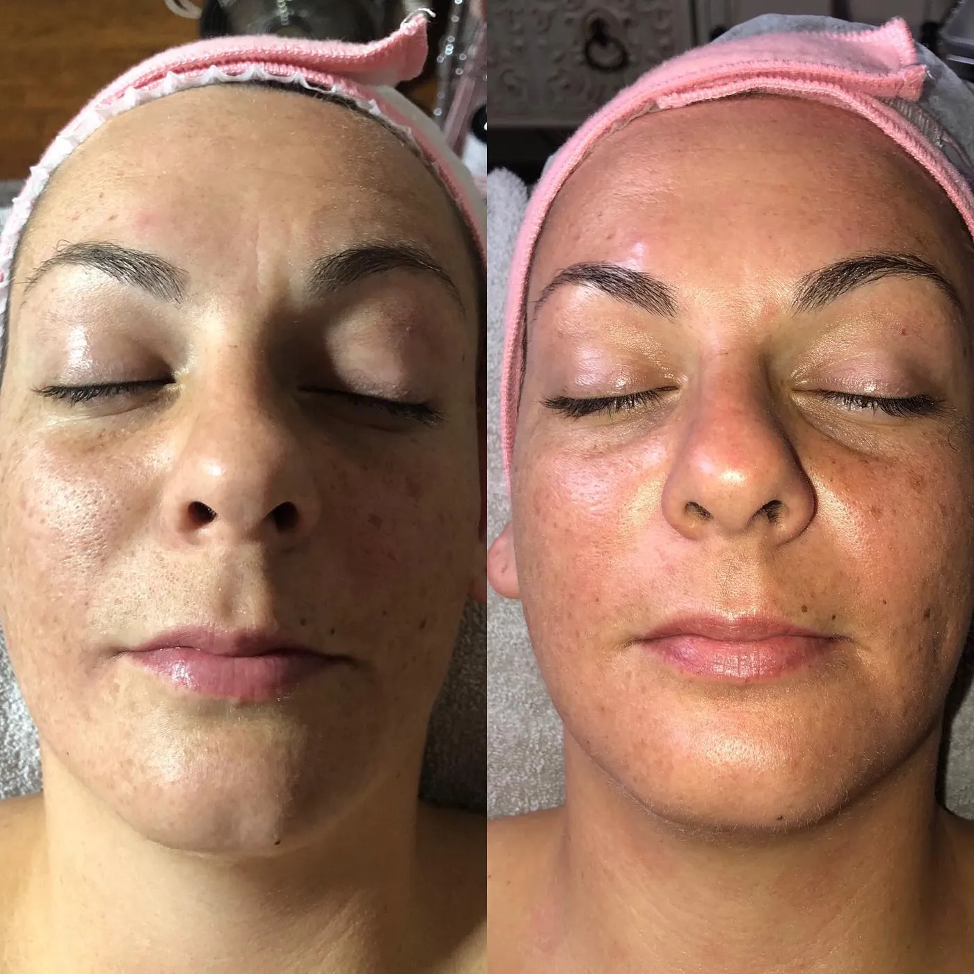Fit and Firm series, before and after