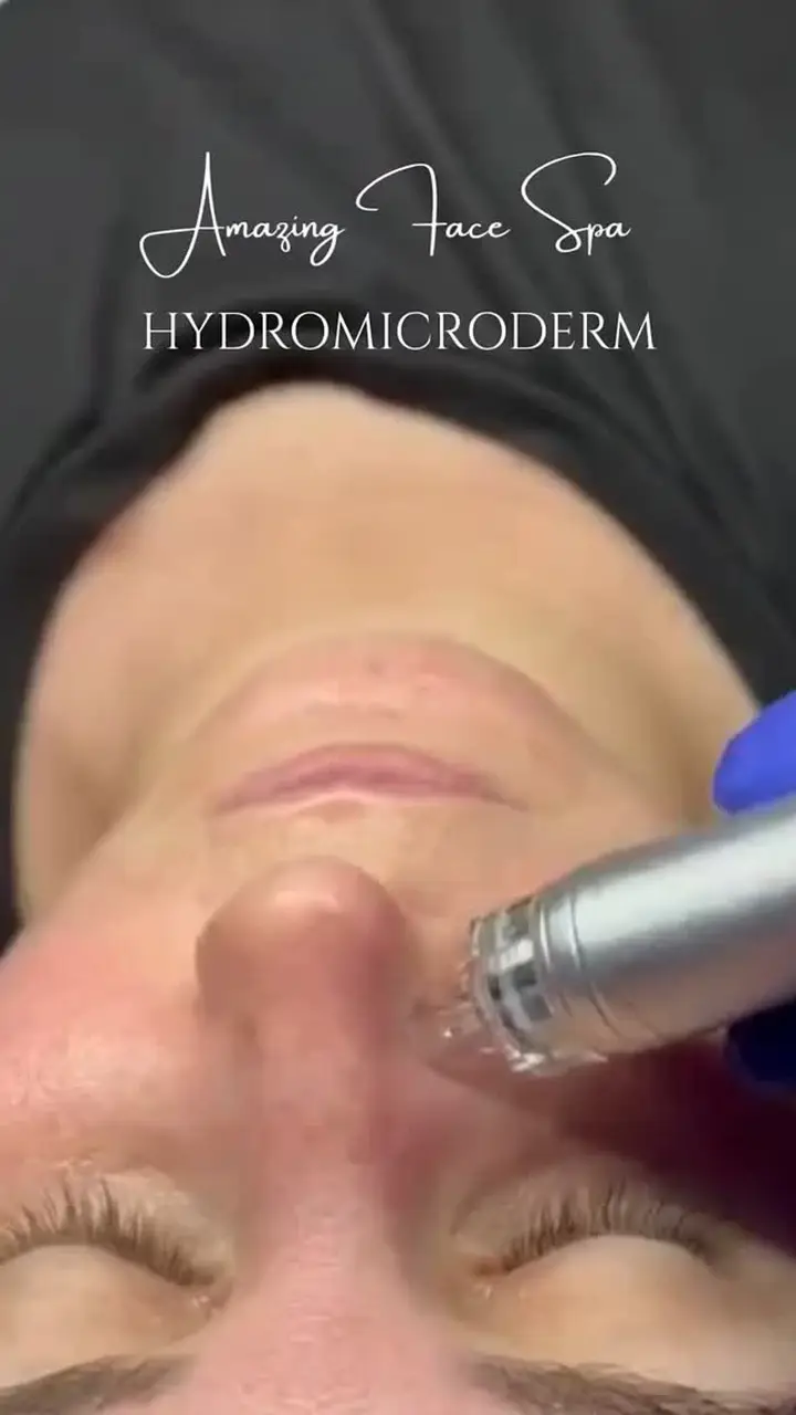 Hydromicrodermabrasion