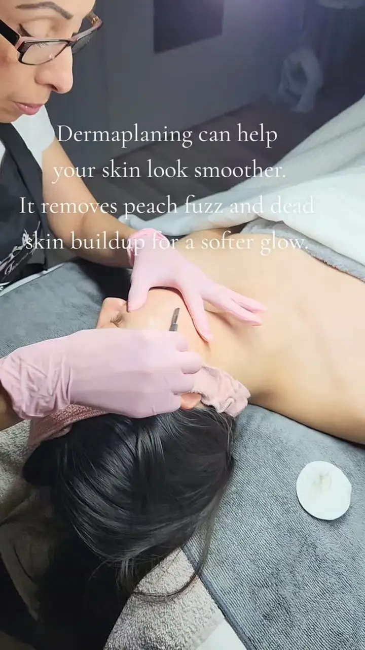 Dermaplaning