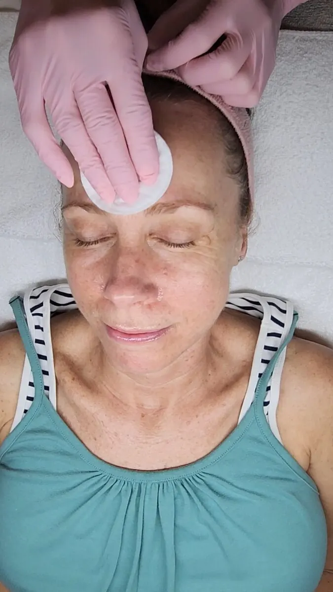 Chemical Peels & Corrective